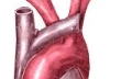 Angina pectoris