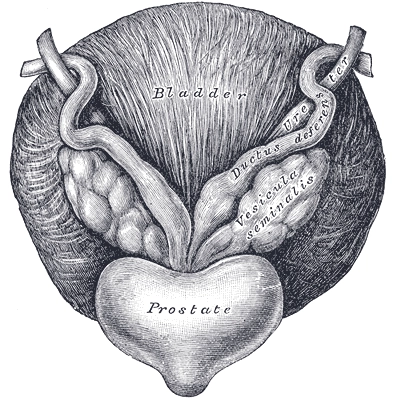 Benigní hyperplazie prostaty